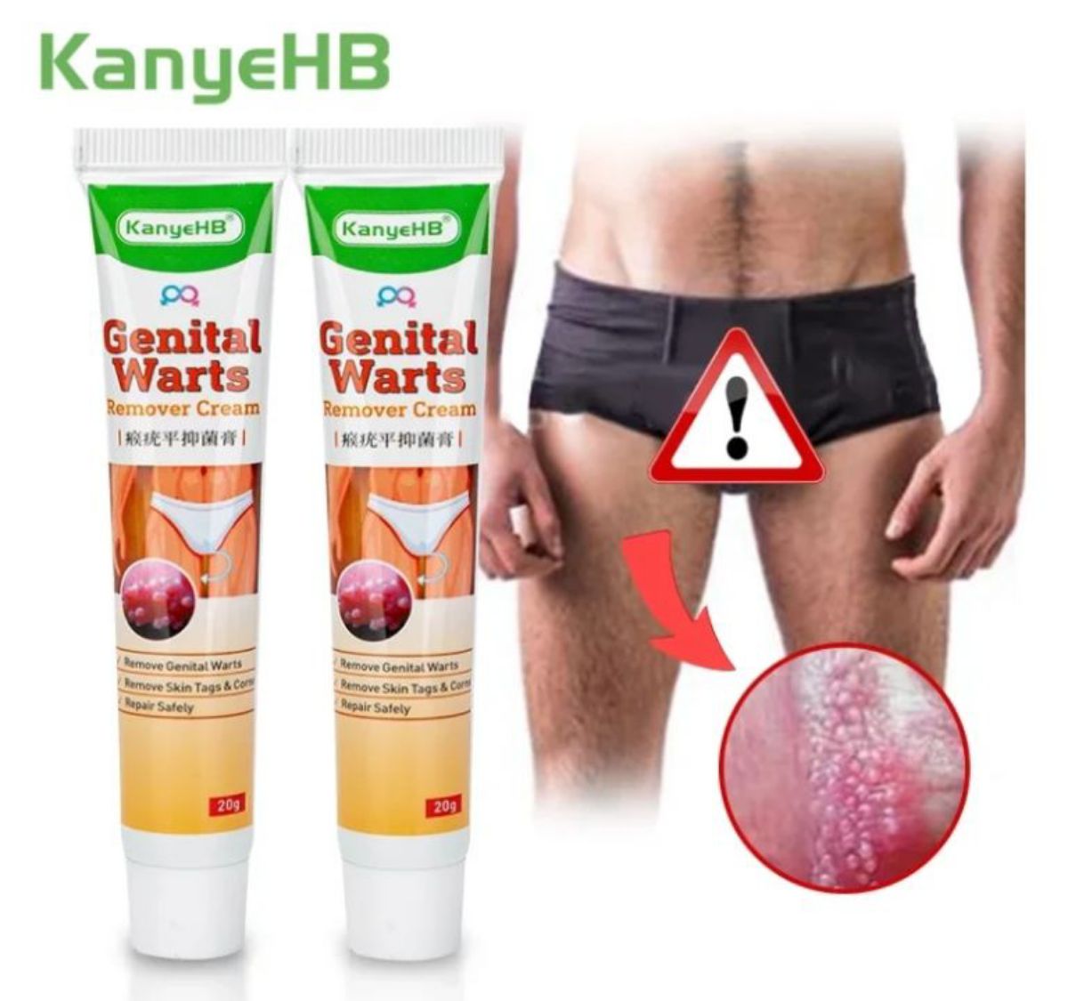 Crème anti-verrues génitales d&rsquo;herpès condylomes - photo 2